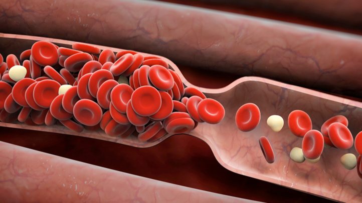 WARNING: Testosterone Therapy Could Cause Blood Clots