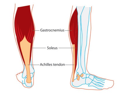 an image outlining the two calf muscles and Achilles tendon